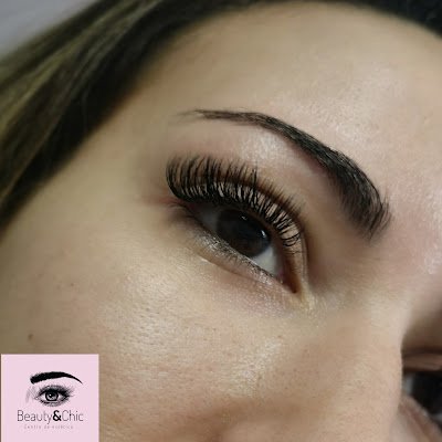 imagen de tratamiento