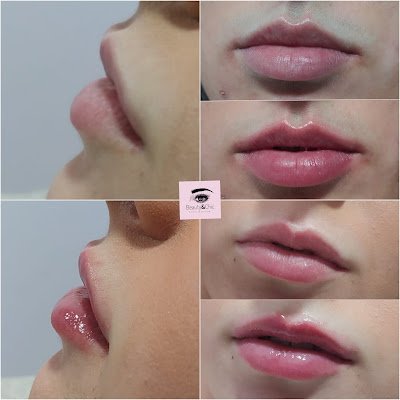 imagen de tratamiento